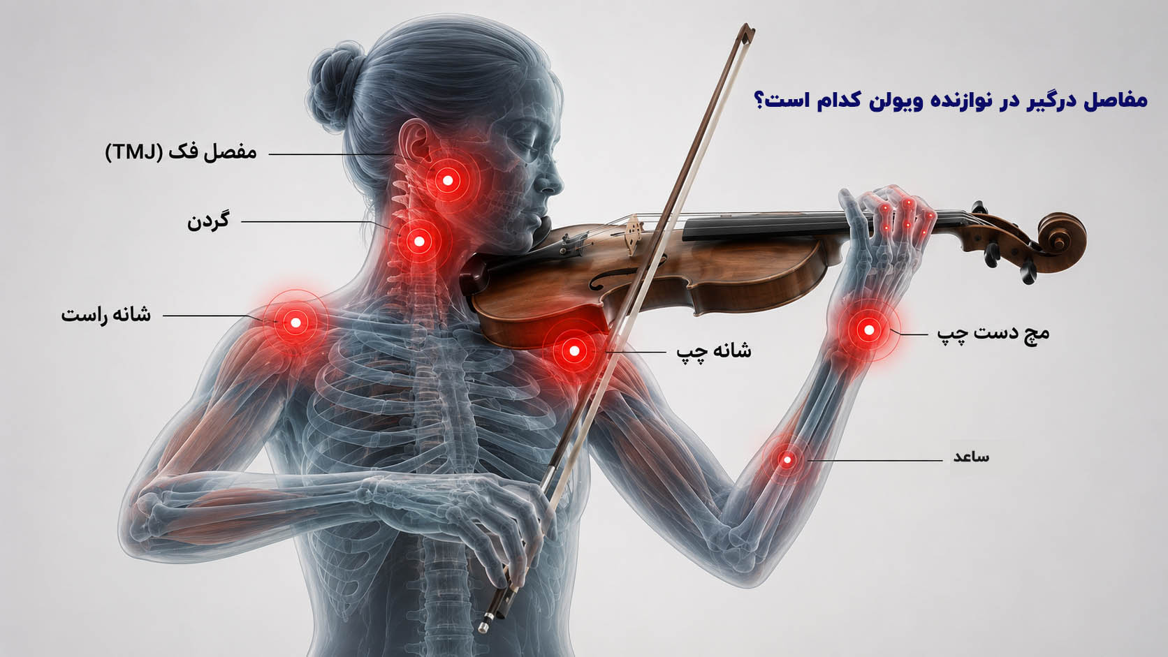 مفاصل درگیر در نوازنده ویولن کدام است؟